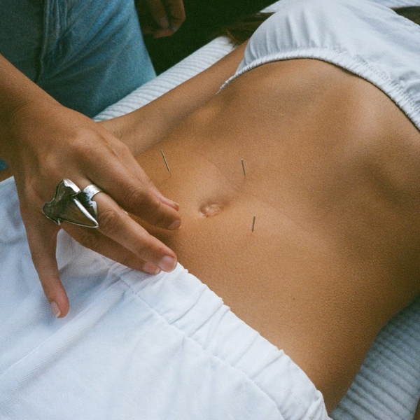 Candlelit Acupuncture & Soundbath
